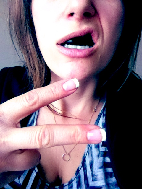 mouth guard