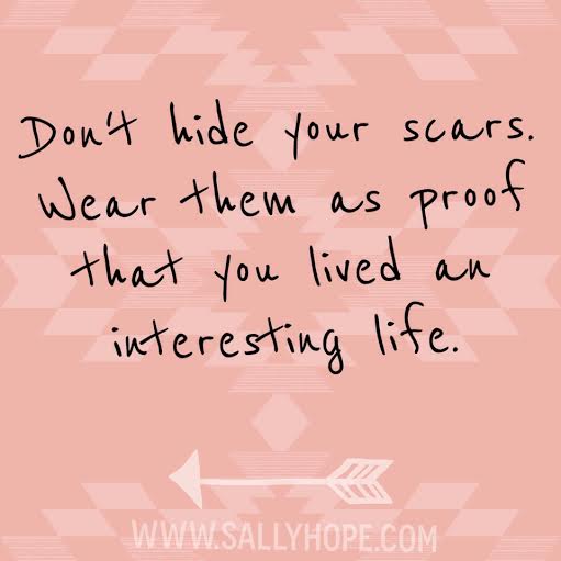 Don't hide your scars